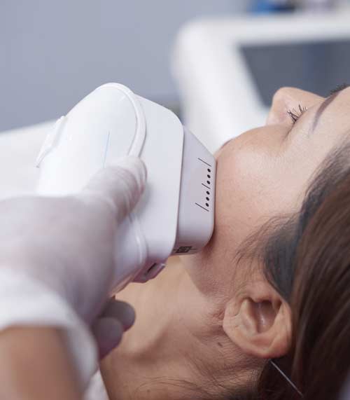 Depilación Láser en Avilés LuceBelleza